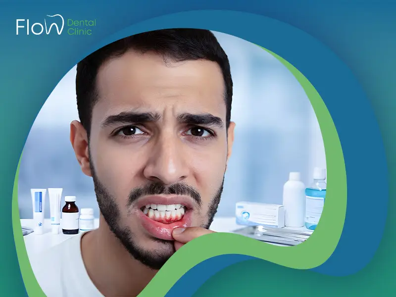 علاج تورم اللثة