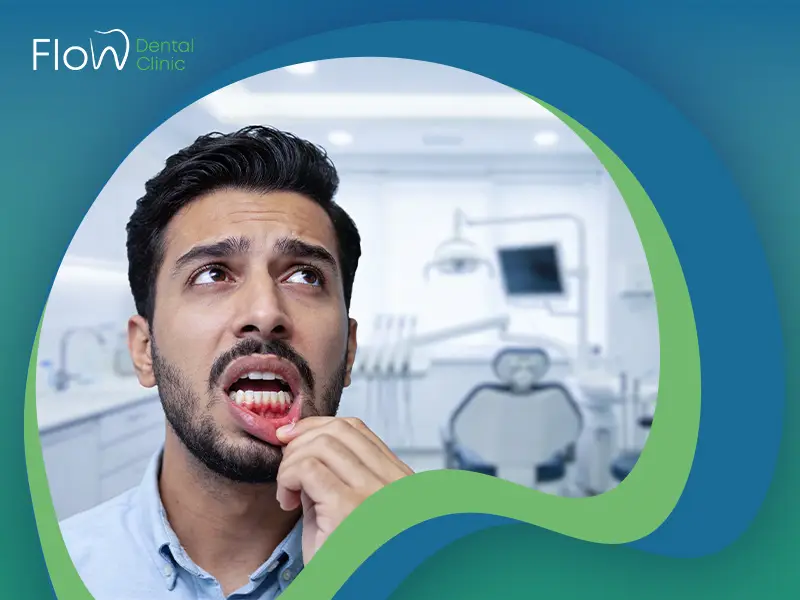 أسباب تورم اللثة