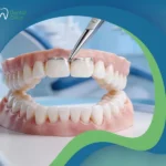 مميزات وعيوب طربوش الأسنان البورسلين