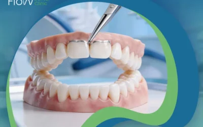 مميزات وعيوب طربوش الأسنان البورسلين