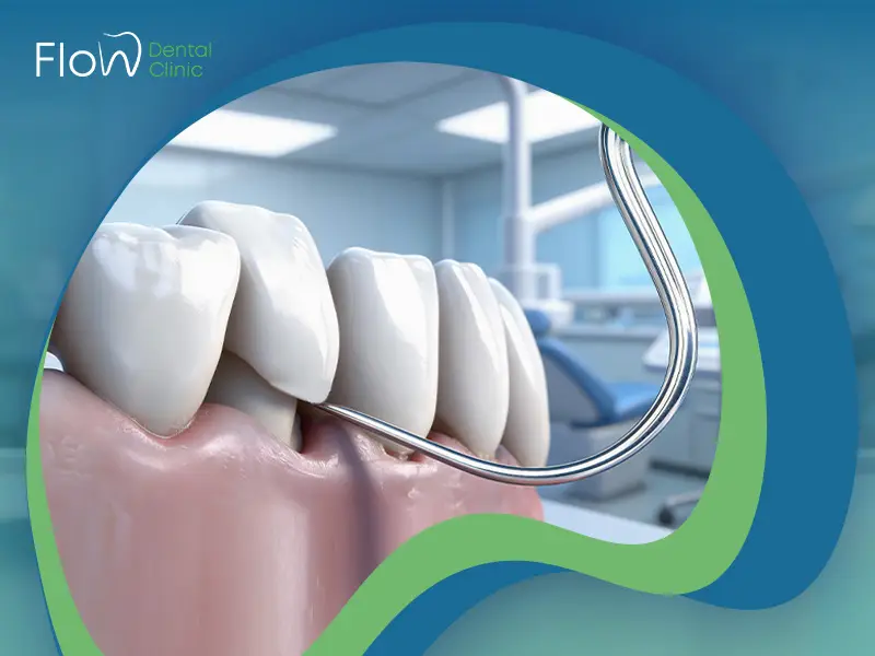 طربوش الأسنان الزيركون